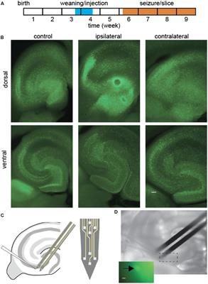 Disrupted Co-activation of Interneurons and Hippocampal Network after Focal Kainate Lesion